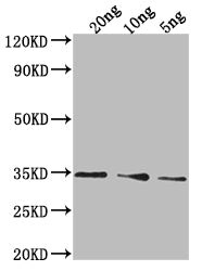 Western Blot
Positive WB detected in Recombinant protein
All lanes: PDAT1 antibody at 1:2000
Secondary
Goat polyclonal to rabbit IgG at 1/50000 dilution
Predicted band size: 26.5 kDa
Observed band size: 35 kDa
