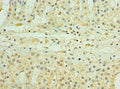 Immunohistochemistry of paraffin-embedded human adrenal gland tissue using CSB-PA887935ESR2HU at dilution of 1:100