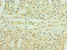 Immunohistochemistry of paraffin-embedded human adrenal gland tissue using CSB-PA887935ESR2HU at dilution of 1:100