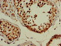 Immunohistochemistry of paraffin-embedded human testis tissue using CSB-PA887936LA01HU at dilution of 1:100