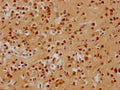 IHC image of CSB-PA887964HA01HU diluted at 1:200 and staining in paraffin-embedded human brain tissue performed on a Leica BondTM system. After dewaxing and hydration, antigen retrieval was mediated by high pressure in a citrate buffer (pH 6.0). Section was blocked with 10% normal goat serum 30min at RT. Then primary antibody (1% BSA) was incubated at 4°C overnight. The primary is detected by a biotinylated secondary antibody and visualized using an HRP conjugated SP system.