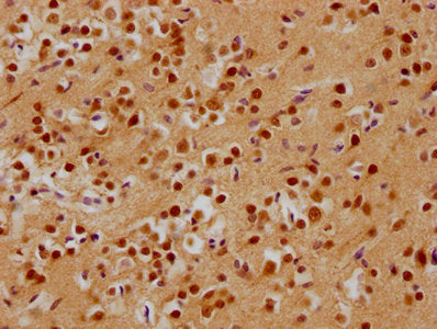 IHC image of CSB-PA887964HA01HU diluted at 1:200 and staining in paraffin-embedded human brain tissue performed on a Leica BondTM system. After dewaxing and hydration, antigen retrieval was mediated by high pressure in a citrate buffer (pH 6.0). Section was blocked with 10% normal goat serum 30min at RT. Then primary antibody (1% BSA) was incubated at 4°C overnight. The primary is detected by a biotinylated secondary antibody and visualized using an HRP conjugated SP system.