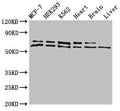 Western Blot
Positive WB detected in: MCF-7 whole cell lysate, HEK293 whole cell lysate, K562 whole cell lysate, Mouse heart tissue, Mouse brain tissue, Mouse liver tissue
All lanes: ACAD9 antibody at 1ug/ml
Secondary
Goat polyclonal to rabbit IgG at 1/50000 dilution
Predicted band size: 69 kDa
Observed band size: 69, 70 kDa