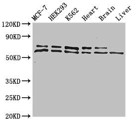 Western Blot
Positive WB detected in: MCF-7 whole cell lysate, HEK293 whole cell lysate, K562 whole cell lysate, Mouse heart tissue, Mouse brain tissue, Mouse liver tissue
All lanes: ACAD9 antibody at 1ug/ml
Secondary
Goat polyclonal to rabbit IgG at 1/50000 dilution
Predicted band size: 69 kDa
Observed band size: 69, 70 kDa