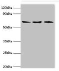 Western blot All lanes: ACAD9 antibody at 6ug/ml Lane 1: MCF-7 whole cell lysate Lane 2: 293T whole cell lysate Lane 3: K562 whole cell lysate Secondary Goat polyclonal to rabbit IgG at 1/10000 dilution Predicted band size: 69 kDa Observed band size: 69 kDa