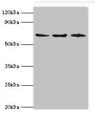Western blot All lanes: ACAD9 antibody at 6ug/ml Lane 1: MCF-7 whole cell lysate Lane 2: 293T whole cell lysate Lane 3: K562 whole cell lysate Secondary Goat polyclonal to rabbit IgG at 1/10000 dilution Predicted band size: 69 kDa Observed band size: 69 kDa