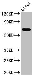 Western Blot
Positive WB detected in: Mouse liver tissue
All lanes: SENP2 antibody at 3.4ug/ml
Secondary
Goat polyclonal to rabbit IgG at 1/50000 dilution
Predicted band size: 68, 67 kDa
Observed band size: 68 kDa
