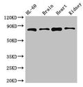 Western Blot
Positive WB detected in: HL60 whole cell lysate, Mouse brain tissue, Mouse heart tissue, Mouse kidney tissue
All lanes: ABCB9 antibody at 5µg/ml
Secondary
Goat polyclonal to rabbit IgG at 1/50000 dilution
Predicted band size: 85, 80, 67, 76, 78 kDa
Observed band size: 85 kDa