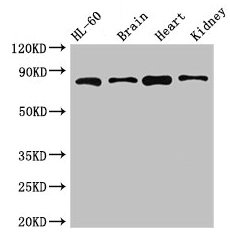 Western Blot
Positive WB detected in: HL60 whole cell lysate, Mouse brain tissue, Mouse heart tissue, Mouse kidney tissue
All lanes: ABCB9 antibody at 5µg/ml
Secondary
Goat polyclonal to rabbit IgG at 1/50000 dilution
Predicted band size: 85, 80, 67, 76, 78 kDa
Observed band size: 85 kDa