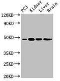 Western Blot
Positive WB detected in: PC-3 whole cell lysate, Mouse kidney tissue, Mouse liver tissue, Rat brain tissue
All lanes: ACP6 antibody at 3ug/ml
Secondary
Goat polyclonal to rabbit IgG at 1/50000 dilution
Predicted band size: 49, 31 kDa
Observed band size: 49 kDa