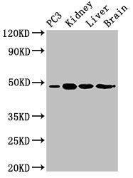 Western Blot
Positive WB detected in: PC-3 whole cell lysate, Mouse kidney tissue, Mouse liver tissue, Rat brain tissue
All lanes: ACP6 antibody at 3ug/ml
Secondary
Goat polyclonal to rabbit IgG at 1/50000 dilution
Predicted band size: 49, 31 kDa
Observed band size: 49 kDa