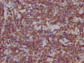 DROSHA Antibody – Figure 1 of 1