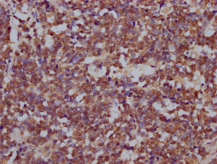 DROSHA Antibody – Figure 1 of 1