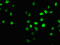 Immunofluorescence staining of A549 cells with CSB-PA889120LA01HU at 1:66, counter-stained with DAPI. The cells were fixed in 4% formaldehyde, permeabilized using 0.2% Triton X-100 and blocked in 10% normal Goat Serum. The cells were then incubated with the antibody overnight at 4&deg;C. The secondary antibody was Alexa Fluor 488-congugated AffiniPure Goat Anti-Rabbit IgG(H+L).