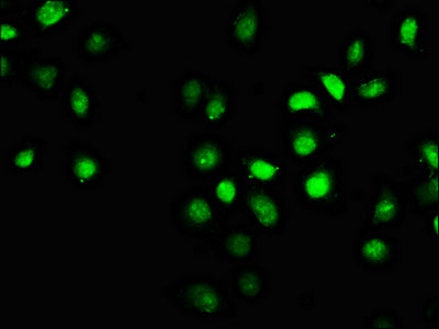 Immunofluorescence staining of A549 cells with CSB-PA889120LA01HU at 1:66, counter-stained with DAPI. The cells were fixed in 4% formaldehyde, permeabilized using 0.2% Triton X-100 and blocked in 10% normal Goat Serum. The cells were then incubated with the antibody overnight at 4&deg;C. The secondary antibody was Alexa Fluor 488-congugated AffiniPure Goat Anti-Rabbit IgG(H+L).