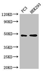 Western Blot
Positive WB detected in: PC-3 whole cell lysate, HEK293 whole cell lysate
All lanes: ACTR10 antibody at 3ug/ml
Secondary
Goat polyclonal to rabbit IgG at 1/50000 dilution
Predicted band size: 47 kDa
Observed band size: 47 kDa