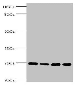 Western blot All lanes: NDUFA13 antibody at 3.97ug/ml Lane 1: 293T whole cell lysate Lane 2: Hela whole cell lysate Lane 3: Jurkat whole cell lysate Lane 4: MCF-7 whole cell lysate Secondary Goat polyclonal to rabbit IgG at 1/10000 dilution Predicted band size: 17, 25 kDa Observed band size: 25 kDa