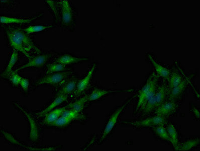 Immunofluorescent analysis of Hela cells using CSB-PA889918LA01HU at dilution of 1:100 and Alexa Fluor 488-congugated AffiniPure Goat Anti-Rabbit IgG(H+L)