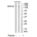 Western blot analysis of extracts from HeLa cells and HuvEc cells, using STK10 antibody.
