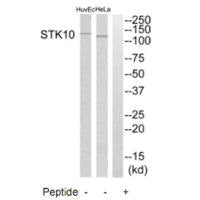 Western blot analysis of extracts from HeLa cells and HuvEc cells, using STK10 antibody.