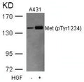 Western blot analysis of extracts from A431 cells untreated or treated with HGF using Met(Phospho-Tyr1234) Antibody.
