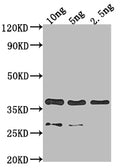Western Blot
Positive WB detected in Recombinant protein
All lanes: VP39 antibody at 1:2000
Secondary
Goat polyclonal to rabbit IgG at 1/50000 dilution
Predicted band size: 35.5 kDa
Observed band size: 36 kDa