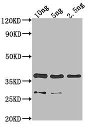 Western Blot
Positive WB detected in Recombinant protein
All lanes: VP39 antibody at 1:2000
Secondary
Goat polyclonal to rabbit IgG at 1/50000 dilution
Predicted band size: 35.5 kDa
Observed band size: 36 kDa