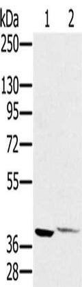 Gel: 8%SDS-PAGE, Lysate: 40 ug, Lane 1-2: Jurkat cells, human lymphoma tissue, Primary antibody: CSB-PA890678(FAIM3 Antibody) at dilution 1/450, Secondary antibody: Goat anti rabbit IgG at 1/8000 dilution, Exposure time: 40 seconds