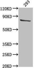 Western Blot
Positive WB detected in: 293 whole cell lysate
All lanes: TBK1 antibody at 1:2000
Secondary
Goat polyclonal to rabbit IgG at 1/50000 dilution
Predicted band size: 84 kDa
Observed band size: 84 kDa