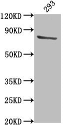 Western Blot
Positive WB detected in: 293 whole cell lysate
All lanes: TBK1 antibody at 1:2000
Secondary
Goat polyclonal to rabbit IgG at 1/50000 dilution
Predicted band size: 84 kDa
Observed band size: 84 kDa