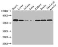Western Blot
Positive WB detected in: Mouse heart tissue, Mouse liver tissue, Mouse spleen tissue, Mouse lung tissue, Mouse kidney tissue, Mouse brain tissue, Mouse skeletal muscle tissue
All lanes: TBX21 antibody at 3µg/ml
Secondary
Goat polyclonal to rabbit IgG at 1/50000 dilution
Predicted band size: 59 kDa
Observed band size: 59 kDa