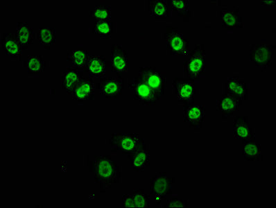 Immunofluorescence staining of Hela cells with CSB-PA890939LA01HU at 1:133, counter-stained with DAPI. The cells were fixed in 4% formaldehyde, permeabilized using 0.2% Triton X-100 and blocked in 10% normal Goat Serum. The cells were then incubated with the antibody overnight at 4°C. The secondary antibody was Alexa Fluor 488-congugated AffiniPure Goat Anti-Rabbit IgG(H+L).