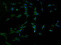 Immunofluorescence staining of MCF-7 cells with CSB-PA890940LA01HU at 1:100, counter-stained with DAPI. The cells were fixed in 4% formaldehyde and blocked in 10% normal Goat Serum. The cells were then incubated with the antibody overnight at 4°C. The secondary antibody was Alexa Fluor 488-congugated AffiniPure Goat Anti-Rabbit IgG(H+L).