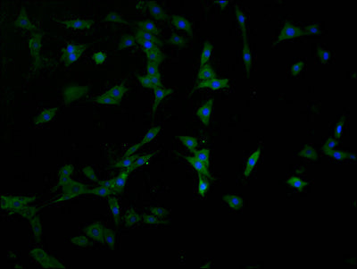 Immunofluorescence staining of MCF-7 cells with CSB-PA890940LA01HU at 1:100, counter-stained with DAPI. The cells were fixed in 4% formaldehyde and blocked in 10% normal Goat Serum. The cells were then incubated with the antibody overnight at 4°C. The secondary antibody was Alexa Fluor 488-congugated AffiniPure Goat Anti-Rabbit IgG(H+L).