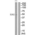Western blot analysis of extracts from K562 cells, using EGR2 antibody.