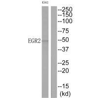 Western blot analysis of extracts from K562 cells, using EGR2 antibody.