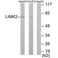 Western blot analysis of extracts from HepG2 cells and HUVEC cells, using LIMK2 antibody.