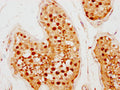 IHC image of CSB-PA891470LA01HU diluted at 1:500 and staining in paraffin-embedded human testis tissue performed on a Leica BondTM system. After dewaxing and hydration, antigen retrieval was mediated by high pressure in a citrate buffer (pH 6.0). Section was blocked with 10% normal goat serum 30min at RT. Then primary antibody (1% BSA) was incubated at 4°C overnight. The primary is detected by a biotinylated secondary antibody and visualized using an HRP conjugated SP system.