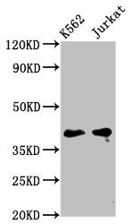Western Blot
Positive WB detected in: K562 whole cell lysate, Jurkat whole cell lysate
All lanes: PURG antibody at 5µg/ml
Secondary
Goat polyclonal to rabbit IgG at 1/50000 dilution
Predicted band size: 40, 37 kDa
Observed band size: 40 kDa