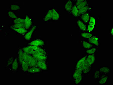 Immunofluorescent analysis of HepG2 cells using CSB-PA891530LA01HU at dilution of 1:100 and Alexa Fluor 488-congugated AffiniPure Goat Anti-Rabbit IgG(H+L)