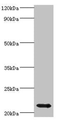 Western blot
All lanes: Heat shock protein beta-8 antibody at 4ug/ml + Rat heart tissue
Secondary
Goat polyclonal to rabbit IgG at 1/10000 dilution
Predicted band size: 22 kDa
Observed band size: 22 kDa