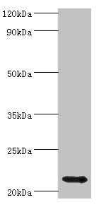 Western blot
All lanes: Heat shock protein beta-8 antibody at 4ug/ml + Rat heart tissue
Secondary
Goat polyclonal to rabbit IgG at 1/10000 dilution
Predicted band size: 22 kDa
Observed band size: 22 kDa