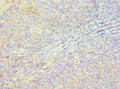Immunohistochemistry of paraffin-embedded human tonsil tissue using CSB-PA891531ESR2HU at dilution of 1:100