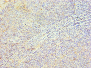 Immunohistochemistry of paraffin-embedded human tonsil tissue using CSB-PA891531ESR2HU at dilution of 1:100