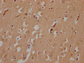 IHC image of CSB-PA891537LA01HU diluted at 1:200 and staining in paraffin-embedded human brain tissue performed on a Leica BondTM system. After dewaxing and hydration, antigen retrieval was mediated by high pressure in a citrate buffer (pH 6.0). Section was blocked with 10% normal goat serum 30min at RT. Then primary antibody (1% BSA) was incubated at 4°C overnight. The primary is detected by a Goat anti-rabbit polymer IgG labeled by HRP and visualized using 0.05% DAB.