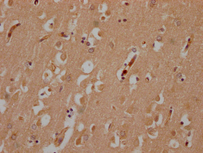 IHC image of CSB-PA891537LA01HU diluted at 1:200 and staining in paraffin-embedded human brain tissue performed on a Leica BondTM system. After dewaxing and hydration, antigen retrieval was mediated by high pressure in a citrate buffer (pH 6.0). Section was blocked with 10% normal goat serum 30min at RT. Then primary antibody (1% BSA) was incubated at 4°C overnight. The primary is detected by a Goat anti-rabbit polymer IgG labeled by HRP and visualized using 0.05% DAB.