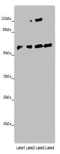 Western blot
All lanes: ANGPTL2 antibody at 8ug/ml
Lane 1: Mouse spleen tissue
Lane 2: K562 whole cell lysate
Lane 3: Hela whole cell lysate
Lane 4: A549 whole cell lysate
Secondary
Goat polyclonal to rabbit IgG at 1/10000 dilution
Predicted band size: 58, 23 kDa
Observed band size: 58 kDa
