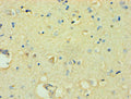 Immunohistochemistry of paraffin-embedded human brain tissue using CSB-PA891721ESR2HU at dilution of 1:100
