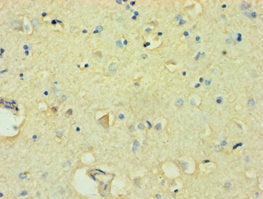 Immunohistochemistry of paraffin-embedded human brain tissue using CSB-PA891721ESR2HU at dilution of 1:100