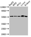 Western Blot
Positive WB detected in: HepG2 whole cell lysate, K562 whole cell lysate, Hela whole cell lysate, Mouse liver tissue, Mouse kidney tissue
All lanes: FBXW2 antibody at 3ug/ml
Secondary
Goat polyclonal to rabbit IgG at 1/50000 dilution
Predicted band size: 52, 45 kDa
Observed band size: 52 kDa